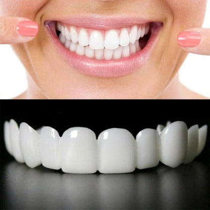 Snap on Smile Instant Confidence with a Brighter